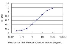 Anti-RNF151 Mouse Monoclonal Antibody [clone: 4G8]