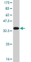 Anti-SNAPC5 Mouse Monoclonal Antibody [clone: 5E2]