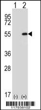 Anti-DDX39A Rabbit Polyclonal Antibody