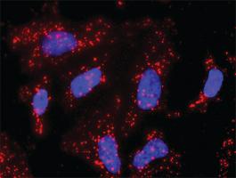 Anti-CACYBP + CTNNB1 Antibody Pair