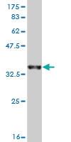 Anti-KHSRP Mouse Monoclonal Antibody [clone: 4C10]