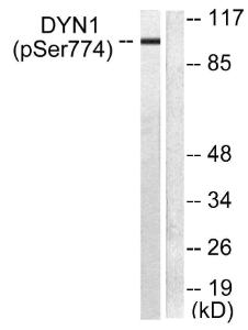 Western blot analysis of lysates from mouse brain using Anti-Dynamin-1 (phospho Ser774) Antibody. The right hand lane represents a negative control, where the antibody is blocked by the immunising peptide.