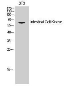 Anti-ICK antibody