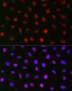 Immunofluorescence analysis of U2OS cells using Anti-AUTS2 Antibody (A306322) at a dilution of 1:50 (40x lens) DAPI was used to stain the cell nuclei (blue)