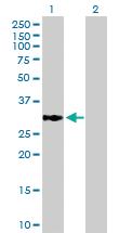 Anti-ECHDC1 Mouse Polyclonal Antibody