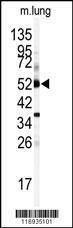 Anti-CYP1A1 Rabbit Polyclonal Antibody