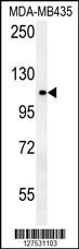 Anti-OTUD4 Rabbit Polyclonal Antibody (AP (Alkaline Phosphatase))