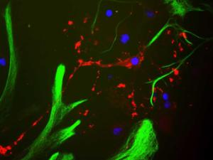 Rat mixed neuron/glial cultures stained with Anti-MBP Antibody (red)