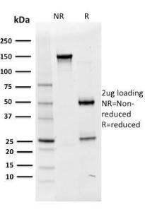 SDS-PAGE analysis of Anti-OCT-2 Antibody [Oct2/2136] under non-reduced and reduced conditions; showing intact IgG and intact heavy and light chains, respectively. SDS-PAGE analysis confirms the integrity and purity of the antibody