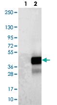 Anti-LURAP1 Rabbit Polyclonal Antibody