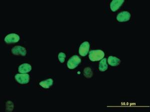 Anti-XRCC5 Mouse Monoclonal Antibody [clone: 3D8]