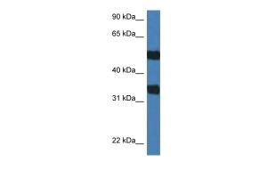 Anti-ARSG Rabbit Polyclonal Antibody