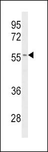 Anti-CYP2C19 Rabbit Polyclonal Antibody