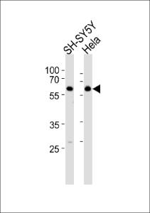 Anti-HDAC2 Rabbit Polyclonal Antibody (HRP (Horseradish Peroxidase))