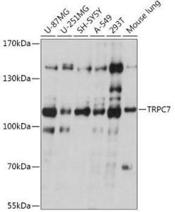 Western blot analysis of extracts of various cell lines, using Anti-TRP 7 Antibody (A309226) at 1:1,000 dilution