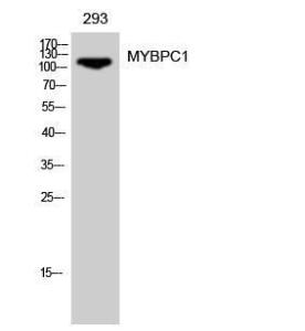 Western blot analysis of 293 cells using Anti-MYBPC1 Antibody