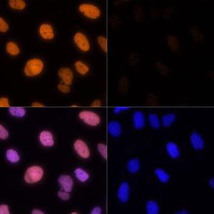 Immunofluorescence analysis of U-2 OS cells using Anti-Histone H1.4 (acetyl Lys26) Antibody (A305416) at a dilution of 1:100. DAPI was used to stain the cell nuclei (blue). U2OS cells were treated by TSA (1 uM) at 37 °C for 18 hours. DAPI was used to stain the cell nuclei (blue)