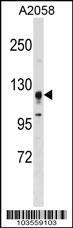 Anti-STK31 Rabbit Polyclonal Antibody (APC (Allophycocyanin))