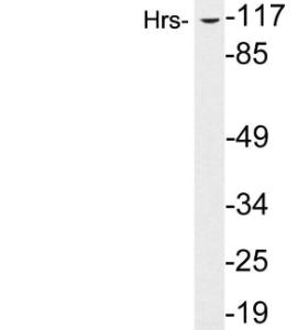 Anti-Hrs antibody