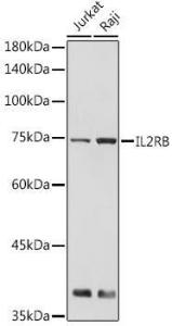 Antibody anti-IL2RB 100 µl