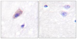 Immunohistochemical analysis of paraffin-embedded human brain using Anti-Dynamin-1 (phospho Ser774) Antibody. The right hand panel represents a negative control, where the antibody was pre-incubated with the immunising peptide.