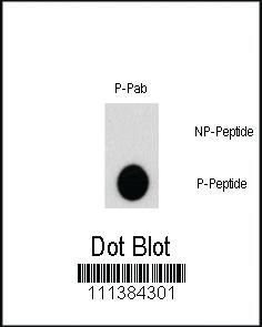 Anti-AKT2 Rabbit Polyclonal Antibody