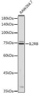 Antibody anti-IL2RB 100 µl