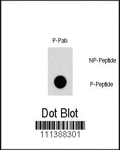 Anti-TSC2 Rabbit Polyclonal Antibody