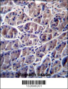 Anti-CAPN8 Rabbit Polyclonal Antibody (FITC (Fluorescein Isothiocyanate))