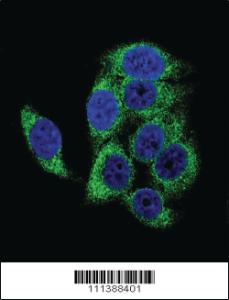 Anti-TSC2 Rabbit Polyclonal Antibody