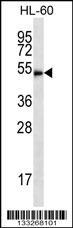 Anti-HDAC3 Rabbit Polyclonal Antibody (FITC (Fluorescein Isothiocyanate))