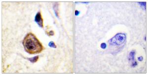 Immunohistochemical analysis of paraffin-embedded human brain using Anti-KCNC4 Antibody. The right hand panel represents a negative control, where the antibody was pre-incubated with the immunising peptide