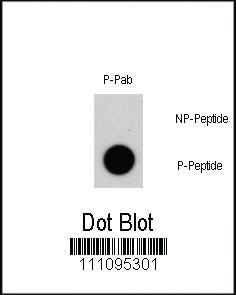 Anti-NR4A1 Rabbit Polyclonal Antibody