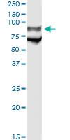 Anti-GP1BA Mouse Monoclonal Antibody [clone: 1C6]