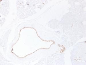 Immunohistochemical analysis of paraffin-embedded human Pancreas using Anti-Cytokeratin 19 Antibody