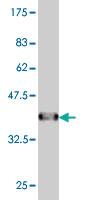 Anti-NR4A2 Mouse Monoclonal Antibody [clone: 3E10]