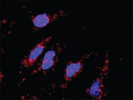 Anti-DKK1 + CTNNB1 Antibody Pair