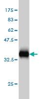 Anti-BIRC5 Mouse Monoclonal Antibody [clone: 5B10]