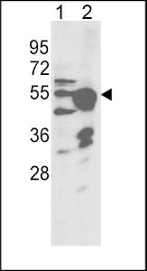 Anti-CYP2R1 Rabbit Polyclonal Antibody