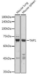 Western blot analysis of extracts of various cell lines, using Anti-TAP1 Antibody (A9816) at 1:1,000 dilution. The secondary antibody was Goat Anti-Rabbit IgG H&L Antibody (HRP) at 1:10,000 dilution.