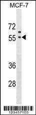 Anti-GORASP1 Rabbit Polyclonal Antibody (HRP (Horseradish Peroxidase))