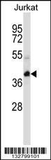 Anti-KCTD10 Rabbit Polyclonal Antibody (FITC (Fluorescein Isothiocyanate))