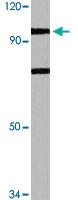 Anti-N4BP1 Rabbit Polyclonal Antibody