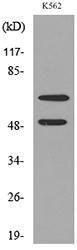 Anti-HDC antibody