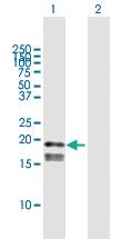 Anti-GP9 Mouse Polyclonal Antibody