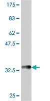 Anti-PCDHA6 Mouse Polyclonal Antibody