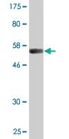 Anti-VWF Mouse Monoclonal Antibody [clone: 1A11]