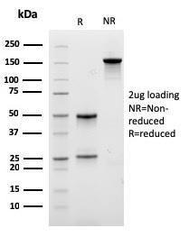 SDS-PAGE analysis of Anti-Lambda Light Chain Antibody [rLLC/3777] under non-reduced and reduced conditions; showing intact IgG and intact heavy and light chains, respectively. SDS-PAGE analysis confirms the integrity and purity of the Antibody