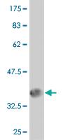 Anti-TCIRG1 Mouse Monoclonal Antibody [clone: 6H3]