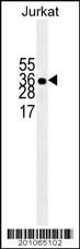 Anti-ELAVL1 Mouse Monoclonal Antibody [clone: 224CT6.5.3]